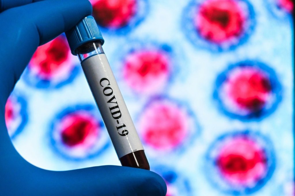 Covid 19 Blood Test